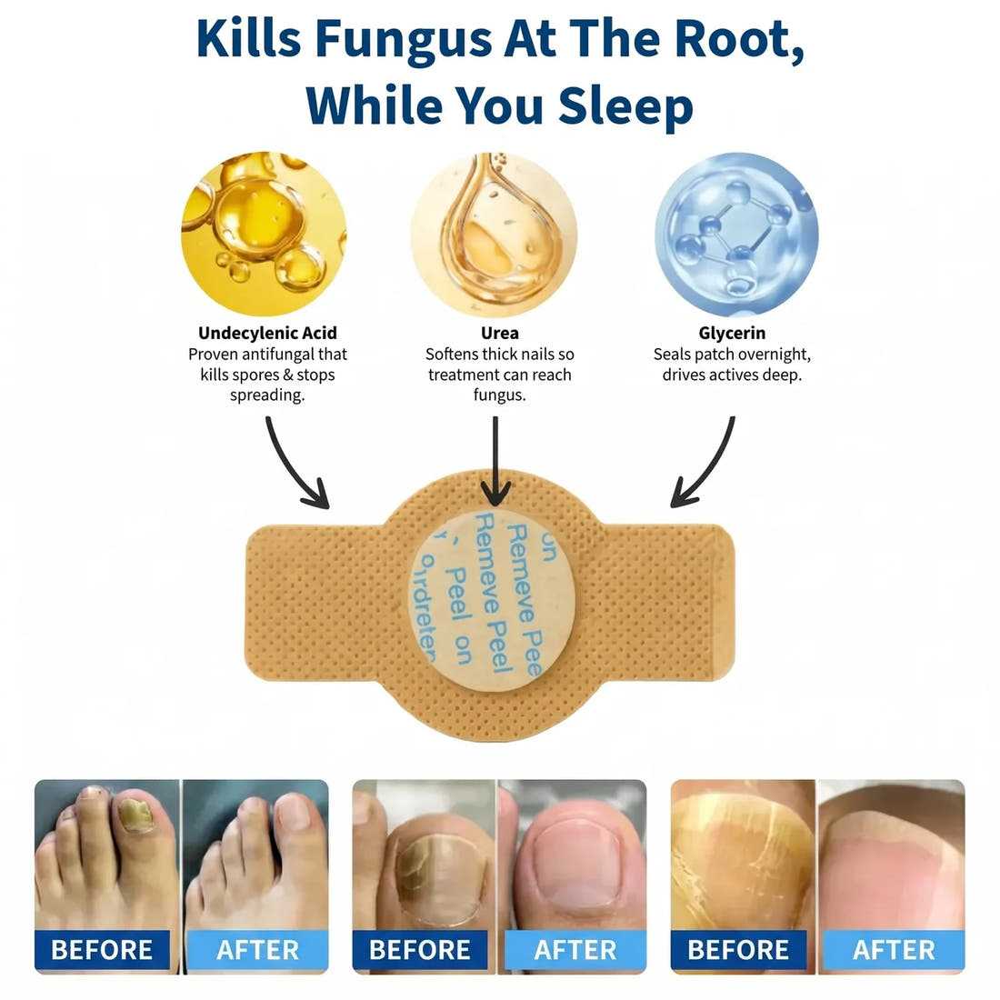Serenbeau™ Fungal Nail Patches