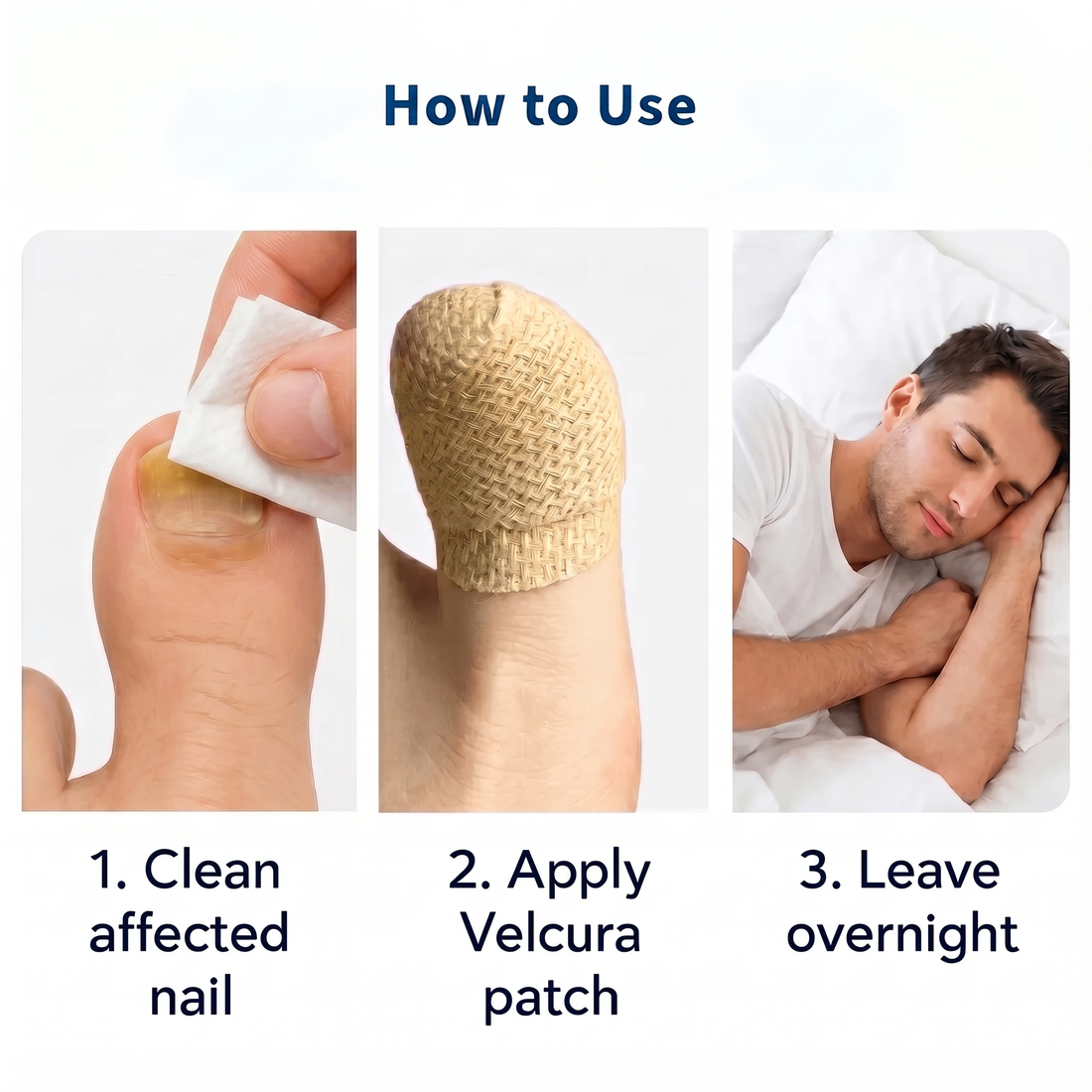 Serenbeau™ Fungal Nail Patches
